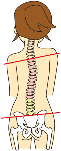 骨盤の歪みから肩の高さまで変わる