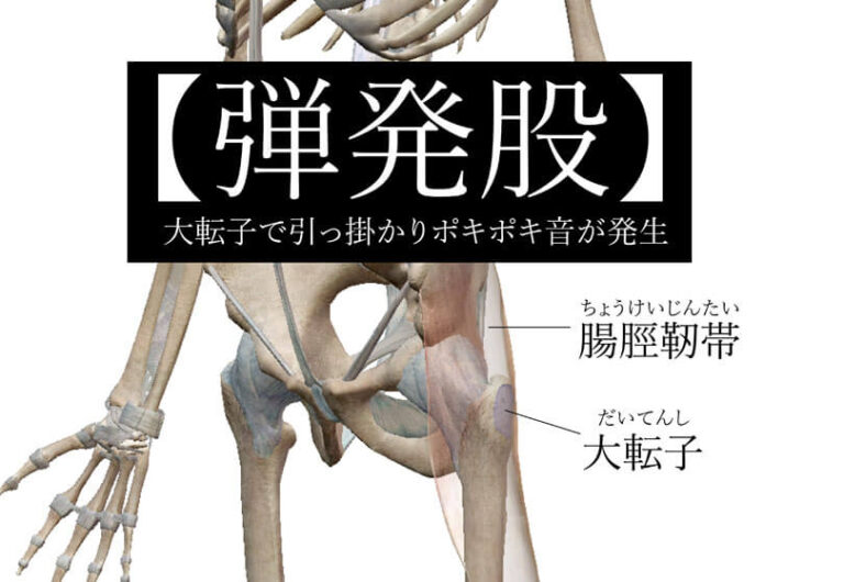 股関節ポキポキの原因【弾発股】とは？