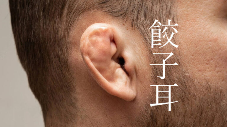 柔道耳（餃子耳）とは？格闘技における原因から予防法まで徹底解説