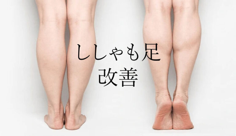 ししゃも足の原因と解消法完全ガイド！美脚を手に入れる方法