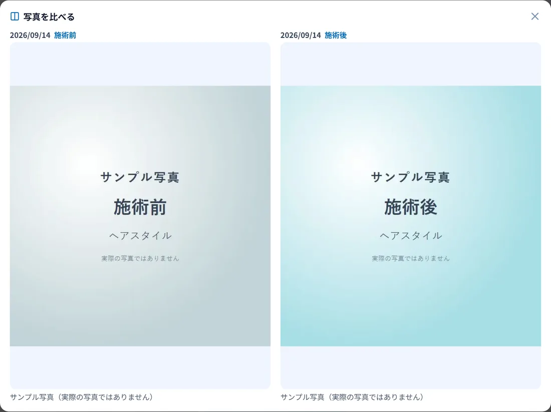 DEEQの施術前・施術後を並べて比較の画面(見本データ)